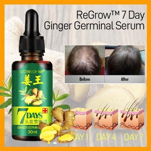 Ginger Germinal Oil Hair Nutrient Solution, Hair Growth Essence Liquid. Fast Natural Hair Loss Treatment, Hair Care